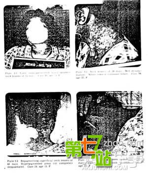 头颅被砍仍有意识？人体那些惊天真相