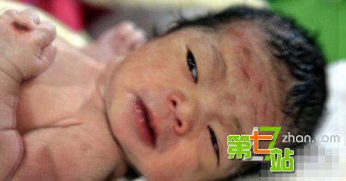 人体“圣痕”之谜：诡异的人体超自然现象