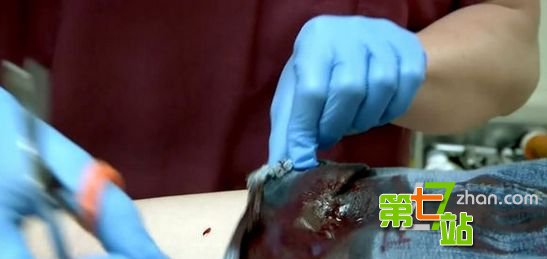 【胆小勿入】停尸房美女尸体竟是这样处理的！